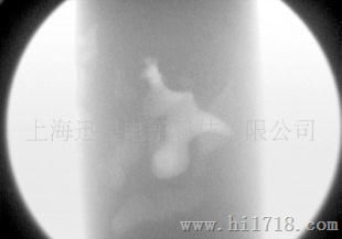 北京X光机