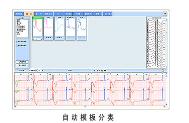 多语言动态心电图工作站