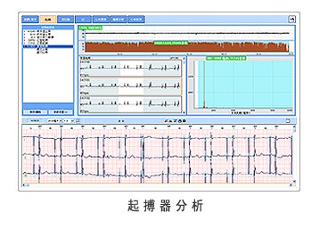 多语言动态心电图工作站