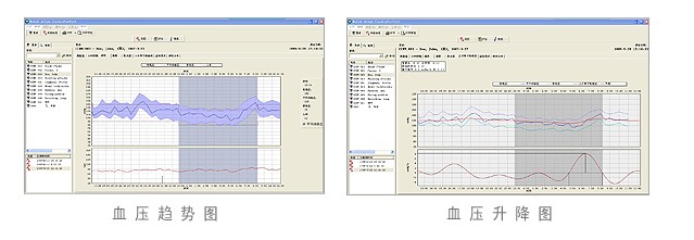美国伟伦ABPM 6100动态血压检测系统