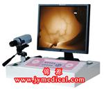 JY-2501B新型红外乳腺诊断仪