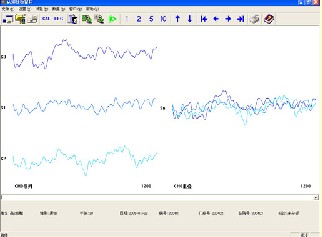 CNV诱发电位仪